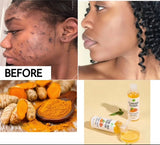 Tumeric toner(120ml)