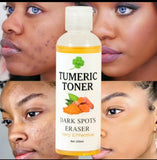 Tumeric toner(120ml)